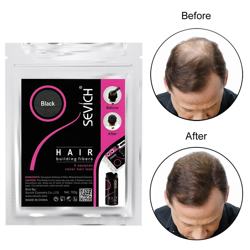 Sevich 100g Hair Fibers Refill Bag