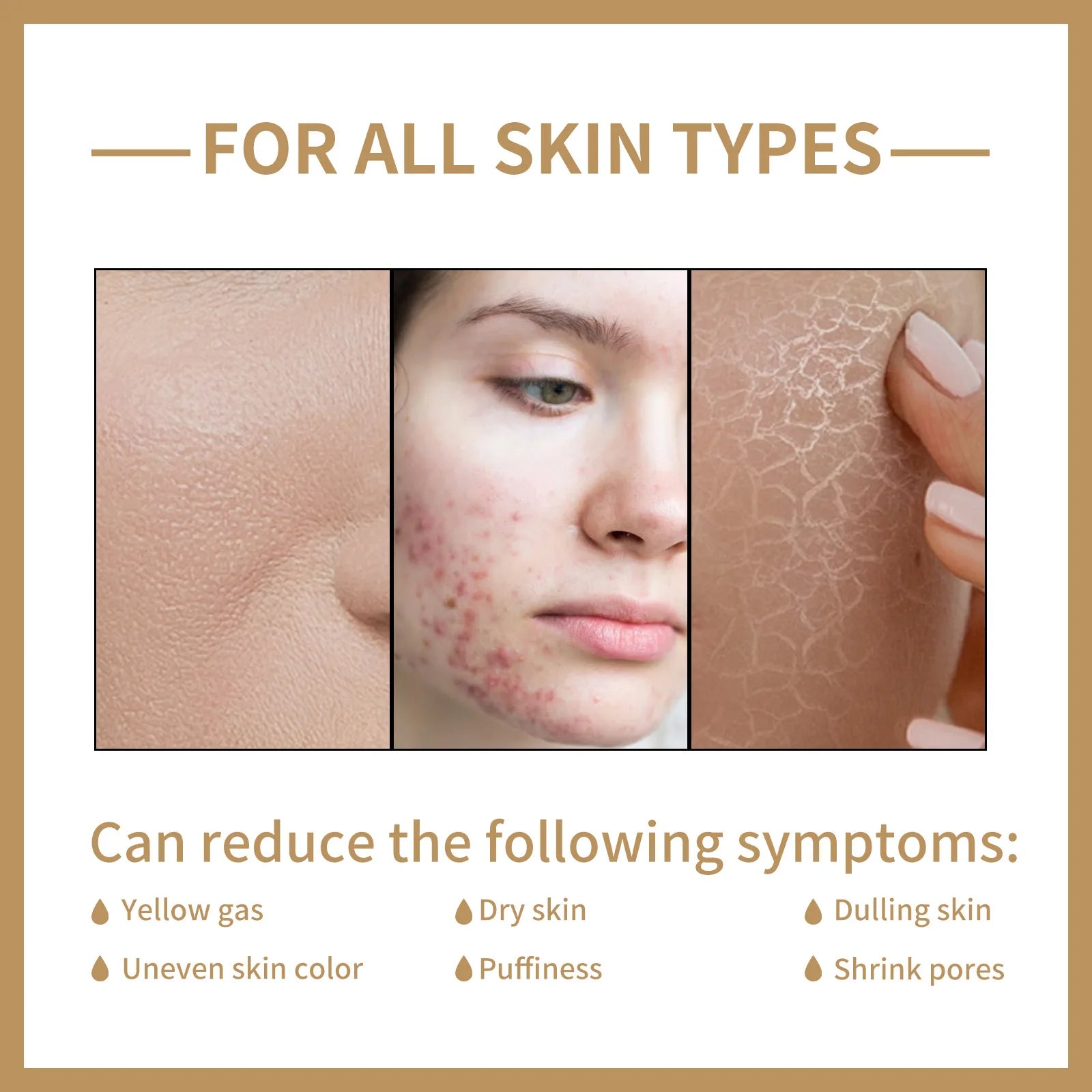 EELHOE Rice Toner - Moisturizing & Oil Control