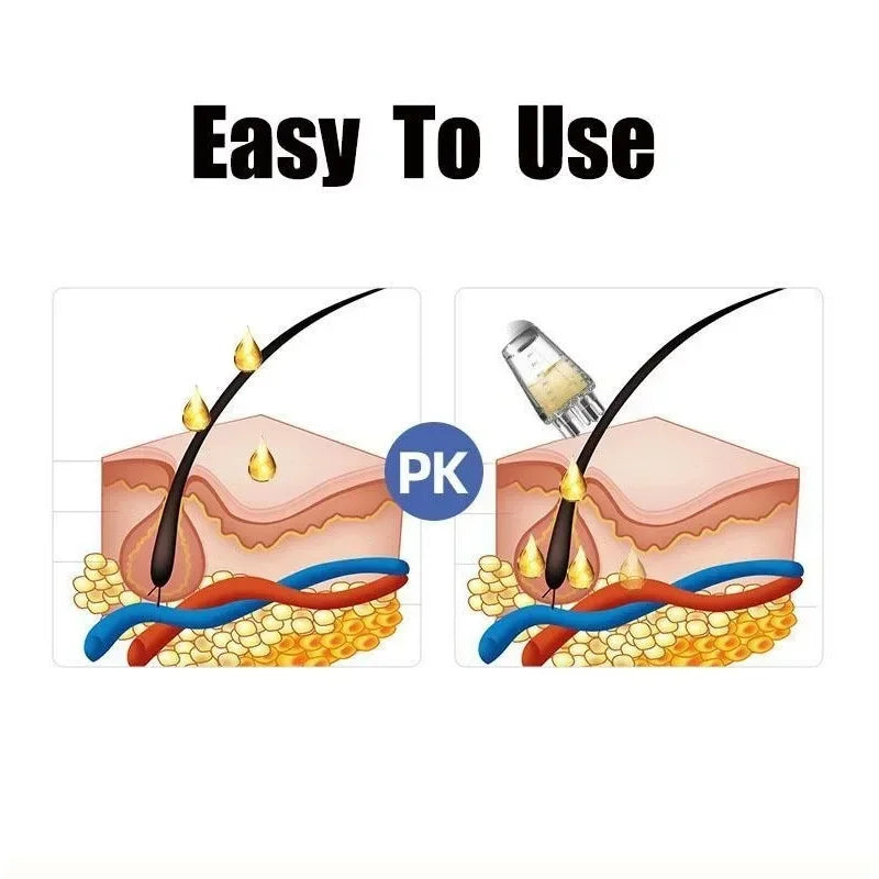 5-Needle Scalp Oil Applicator & Massage Comb