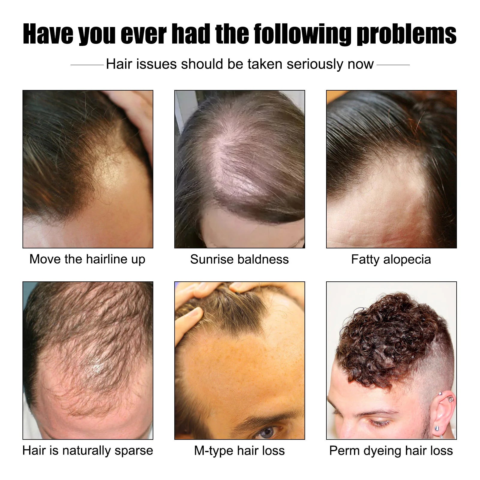 Vitamin E Hair Growth Oil